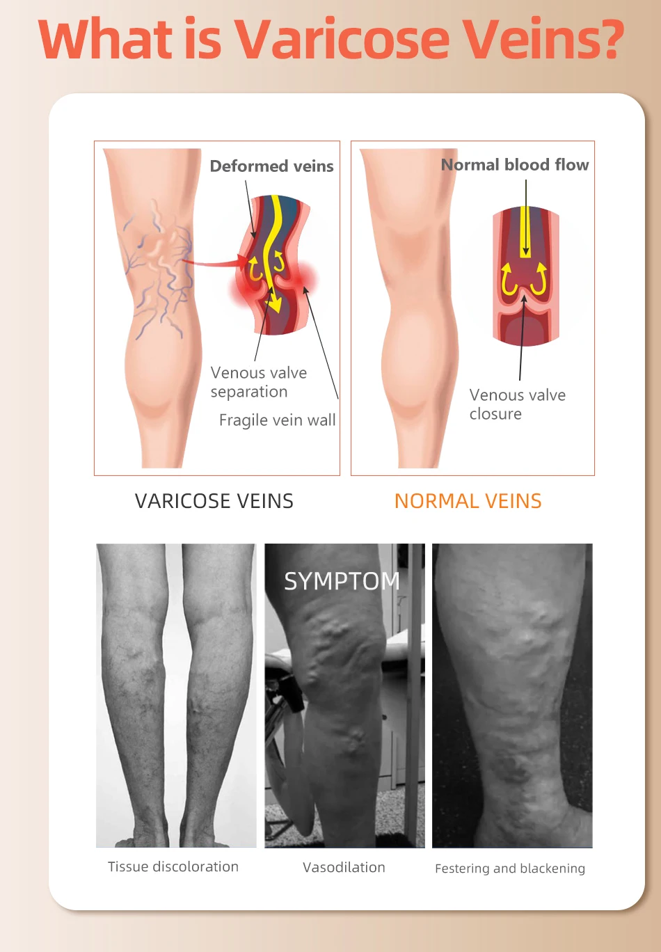 30-40 мм рт. ст., носки выше к – обзор и цена Compression Sock Medical